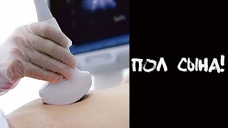 АНЕКДОТ НА УЗИ!