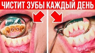 8 ОШИБОК в Уходе За ЗУБАМИ, Которые СОВЕРШАЕТ КАЖДЫЙ!