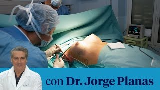 ¿Los implantes de senos son para toda la vida?