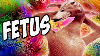 FETUS PICS! - (Fridays With PewDiePie - Part 79)