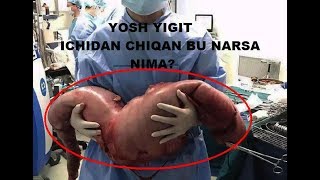 22 YOSHLI BOLANI ICHIDAN CHIQAN BU NARSA NIMA???