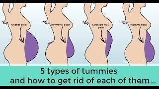 5 types of belly that aren't caused by excess weight
