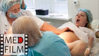 Роды. Перидуральная (эпидуральная) анестезия © Сhildbirth. Peridural anesthesia