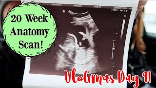 OUR 20 WEEK ANATOMY SCAN | Lesbian Pregnancy | Vlogmas Day 9