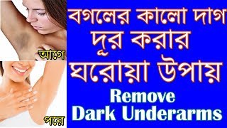 dark underarms home remedy | বগলের কালো দাগ দূর করার উপায় | b2unews bangla| bangla health tips