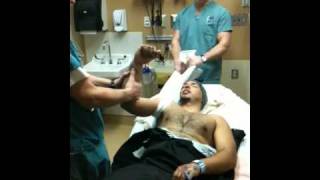 Dislocated shoulder