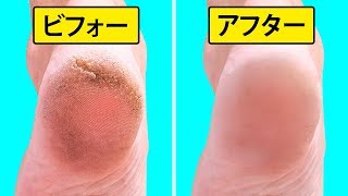 柔らかく滑らかな足にするために家庭で出来る10のフットケア