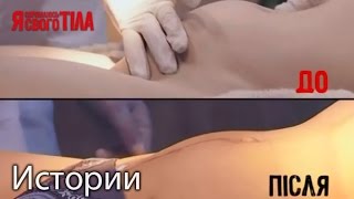 Оксану Цыбыногу прооперировали и удалили опухоль