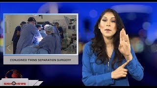 Conjoined twins separation surgery (ASL - 11.10.18)