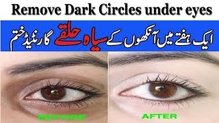 How to remove dark Circles under eyes naturally in 3 Days | Anam Home Remedy