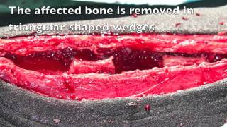 A Case of Dorsal Spinal Process Impingement in a Horse - Treatment of kissing spines