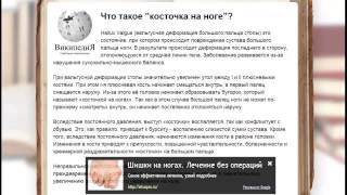 как размягчить косточки на ногах