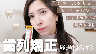 【歯列矯正#3】アンカースクリュー矯正スタート?痛みは…？歯磨き事情&使っている歯ブラシ【口元の変化】