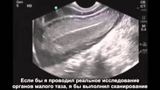 Порядок выполнения: трансвиганальное ультразвуковое исследование у женщин.