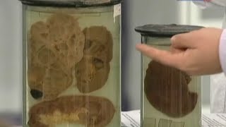 Вред алкоголя - вся правда. Последствия употребления алкоголя