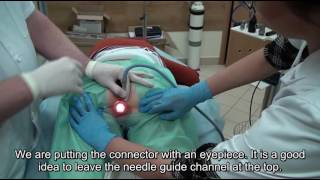 Sclerotheraphy treatment EN