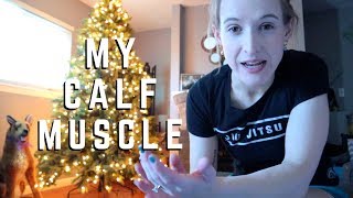AMPUTEE CALF MUSCLES: Can I still control it?