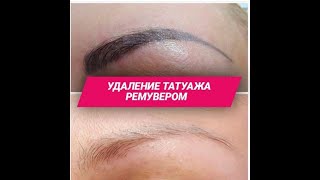 Удаление Ремувером Мастер-класс от Топ Мастера Факультета Красоты Вячеслава Заботина
