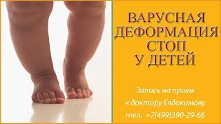 Варусная деформация стоп у детей. Варус причины, симптомы, лечение остеопатией.