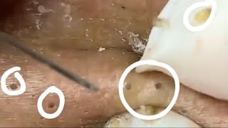 Tratamento facial para pele brilhante #09   Facial Treatment for Glowing Skin