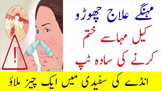 Chehre K Daag Dhabe aur Keel Muhase Khatam Karne Ka Tarika in Urdu/Hindi