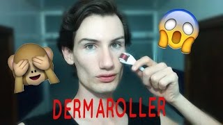 COMO ELIMINAR CICATRICES, ARRUGAS Y MANCHAS--DERMAROLLER