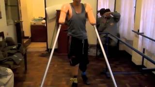 CMA Patient - A young amputee who lost all 4 limbs