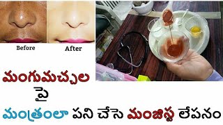 తెల్లారేసరికి మంగుమచ్చల ను మాయం చేసి ఎందరినో ఆశ్చర్యపరిచిన మంజిష్ట లేపనం ! Cure Hyperpigmentation