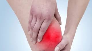 Symptômes de l’arthrose du genou.