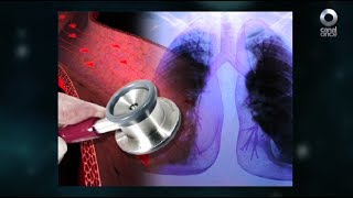 Diálogos en confianza (Salud) - Hipertensión pulmonar (12/06/2017)