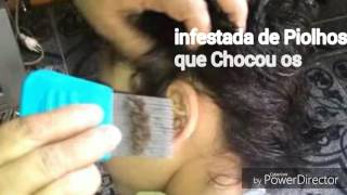Menina infestada de piolhos choca internautas - Dicas para acabar e prevenir piolhos | DC Natural