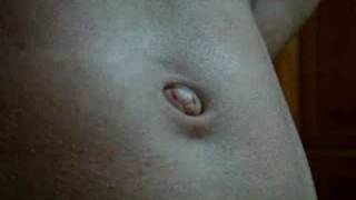 belly button inny or outie... or both navel?