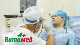 Лазерное исправление носовой перегородки в Воронеже, в медцентре «Витамед» (фрагмент операции)