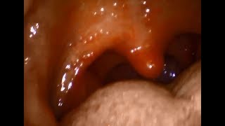Inside another male friends mouth and throat vore part 3