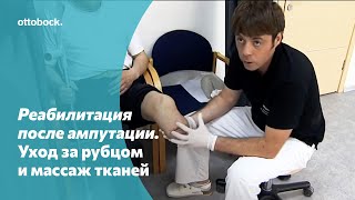 Профилактика рубцов после ампутации