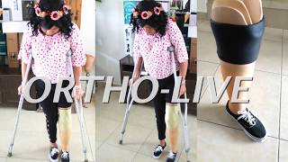 PRÓTESIS DE PIERNA PARA AMPUTACIÓN TRANSTIBIAL ORTHO-LIVE