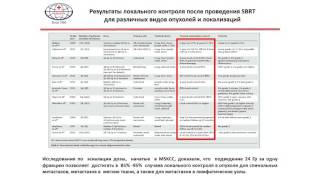 Стереотаксическая лучевая терапия