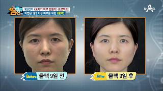 지성 피부를 위한 ‘물팩’의 효과! ‘물’ 하나로 유수분 밸런스 사수?! | 나는 몸신이다