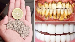 كيف بيضت أسناني في المنزل في 3 أيام و ازلت الجير و بلاك الأسنان دون الذهاب إلى طبيب الأسنان تبييض