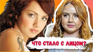 Что случилось с лицом певицы МакSим?