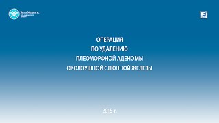 Удаление плеоморфной аденомы околоушной слюнной железы