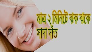 মাত্র ২ মিনিটে করে ফেলুন ঝকঝকে সাদা দাঁত || Matro 2 Minite Jhok Jhoke Sada Dat