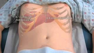 Macleod's Physical Examination Of The Abdomen - OSCE Guide 2016