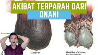 Akibat terparah dari onani... Fournier Gangren