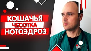 Кошачья чесотка или нотоэдроз кошек