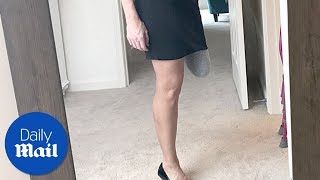 Missouri woman with 'ugly' leg gets it amputated - Daily Mail