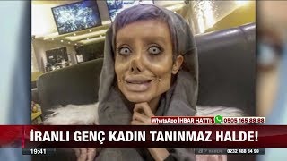 İranlı genç kadın tanınmaz halde - 1 Aralık 2017