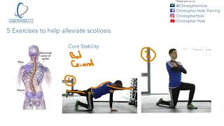 5 exercises that help alleviate scoliosis