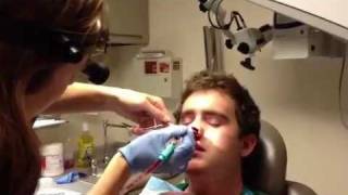 Ian's nasal packing removal