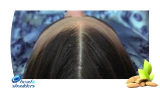 Как работает коллекция Head & Shoulders Увлажняющий уход за кожей головы».